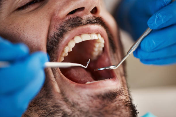 Best Same-Day Emergency Dentist in Geronimo, OK