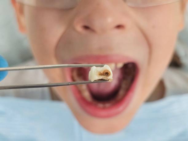 Best Walk-In Emergency Dentist in Geronimo, OK